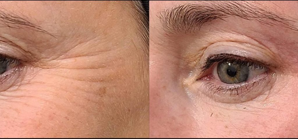 Before After Case 02