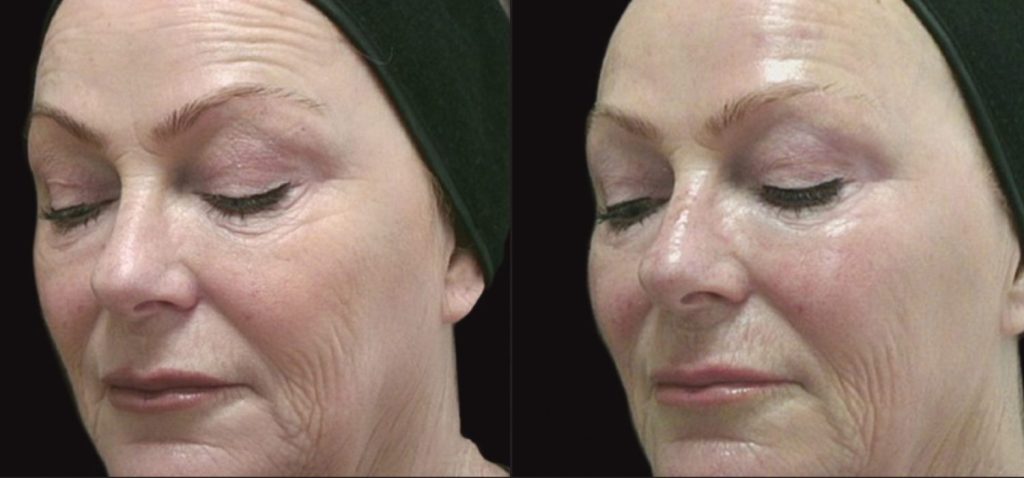 Before After Case 05